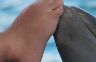 curacao dolphin herapy center